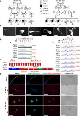 Novel Loss-of-Function Mutations in DNAH1 Displayed Different Phenotypic Spectrum in Humans and Mice